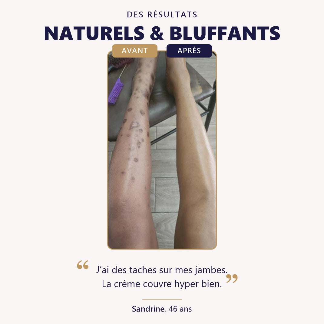 Perfecteur de Couverture WK